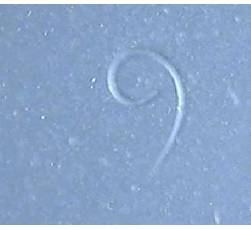 Larva de triquina al estereomicroscopio