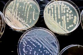 Aspecto del crecimiento de Erwinia amylovora en los medios de cultivo